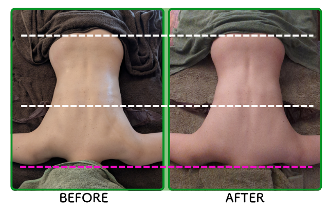 BEFORE/AFTER・お客様の声をご紹介