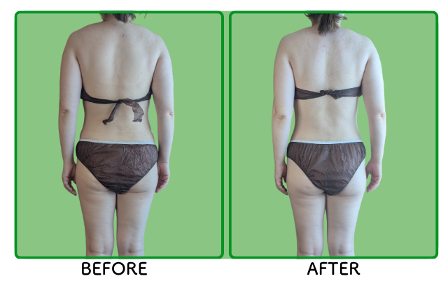 BEFORE/AFTER・お客様の声をご紹介