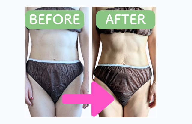 BEFORE/AFTER・お客様の声をご紹介